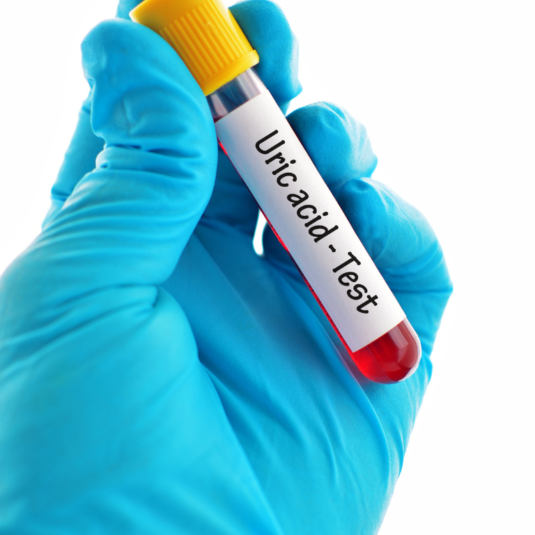 Kidney Cleansing for Uric Acid and Gout